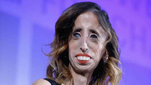 Worlds Ugliest Woman Says Label Was A Blessing