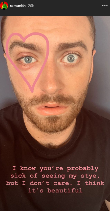 Sam Smith shows off his new look after undergoing eye operation to ...